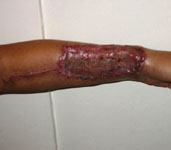 arm