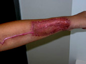 arm