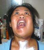 Open Wide
